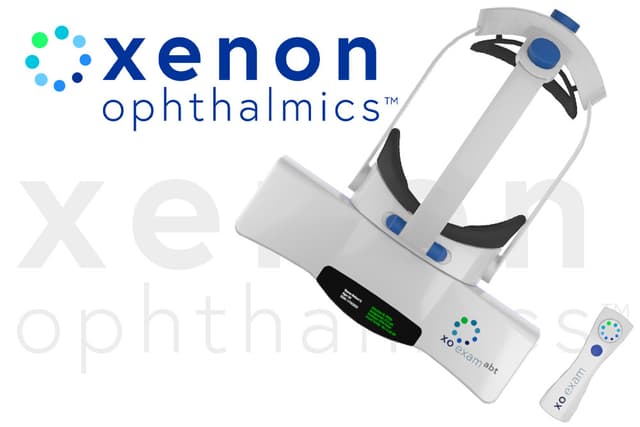 Xenon XO Exam™ System